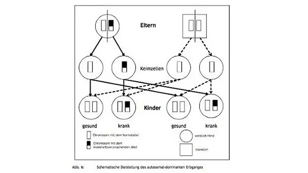 Schematische Darstellung eines autosomal-dominanten Erbgangs. Oben sind die Eltern dargestellt, jeweils mit zwei Chromosomenpaaren, wobei ein Elternteil ein krankheitsverursachendes Allel trägt (schwarz markiert) und der andere gesunde Allele (weiß markiert). In der mittleren Reihe sind die Keimzellen der Eltern abgebildet, die entweder ein normales oder ein krankheitsverursachendes Chromosom enthalten. Unten sind die möglichen genetischen Kombinationen der Kinder gezeigt: jeweils die Hälfte der Kinder ist gesund (nur weiße Allele), während die andere Hälfte das krankheitsverursachende Allel erbt (eine schwarze und eine weiße Markierung). Die Geschlechter sind durch Kreise (weiblich) und Quadrate (männlich) unterschieden.